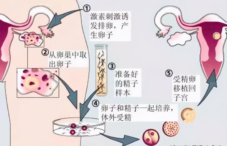代孕移植